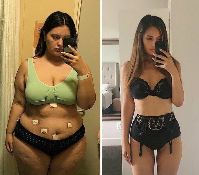 Девушка до и после похудения с капсулой KETO Complete